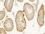 TIA-1 Antibody in Immunohistochemistry (Paraffin) (IHC (P))