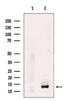 UQCRB Antibody in Western Blot (WB)