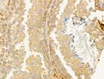 CYLD Antibody in Immunohistochemistry (Paraffin) (IHC (P))