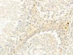 CYLD Antibody in Immunohistochemistry (Paraffin) (IHC (P))