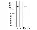 CYLD Antibody in Western Blot (WB)