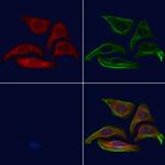 ETFB Antibody in Immunocytochemistry (ICC/IF)