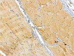 ETFB Antibody in Immunohistochemistry (Paraffin) (IHC (P))