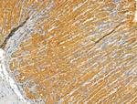 ETFB Antibody in Immunohistochemistry (Paraffin) (IHC (P))