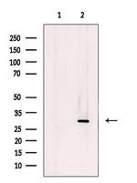 ETFB Antibody in Western Blot (WB)