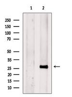 ETFB Antibody in Western Blot (WB)