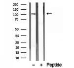 EXOC1 Antibody in Western Blot (WB)