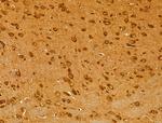 GSTA4 Antibody in Immunohistochemistry (Paraffin) (IHC (P))