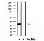 GSTA4 Antibody in Western Blot (WB)