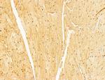 OIP5 Antibody in Immunohistochemistry (Paraffin) (IHC (P))