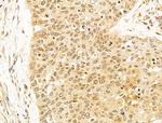 OIP5 Antibody in Immunohistochemistry (Paraffin) (IHC (P))