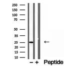 OIP5 Antibody in Western Blot (WB)