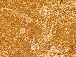 OTUD7B Antibody in Immunohistochemistry (Paraffin) (IHC (P))