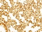 OTUD7B Antibody in Immunohistochemistry (Paraffin) (IHC (P))