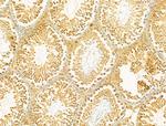 SBP2 Antibody in Immunohistochemistry (Paraffin) (IHC (P))