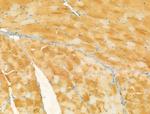 UQCRFS1 Antibody in Immunohistochemistry (Paraffin) (IHC (P))