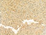 UQCRFS1 Antibody in Immunohistochemistry (Paraffin) (IHC (P))