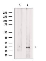 UQCRFS1 Antibody in Western Blot (WB)