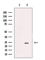 UQCRFS1 Antibody in Western Blot (WB)