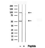 ACADVL Antibody in Western Blot (WB)