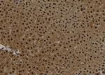 Centrin 2 Antibody in Immunohistochemistry (Paraffin) (IHC (P))