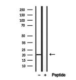 Centrin 2 Antibody in Western Blot (WB)