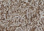 CREB3L1 Antibody in Immunohistochemistry (Paraffin) (IHC (P))