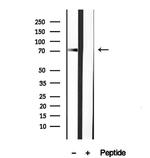 DNAJC10 Antibody in Western Blot (WB)