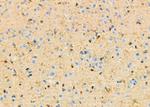 IVD Antibody in Immunohistochemistry (Paraffin) (IHC (P))