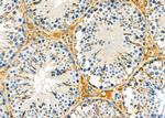 IVD Antibody in Immunohistochemistry (Paraffin) (IHC (P))