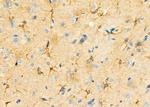 IVD Antibody in Immunohistochemistry (Paraffin) (IHC (P))