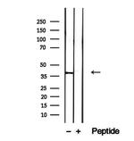 IVD Antibody in Western Blot (WB)