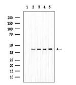 IVD Antibody in Western Blot (WB)