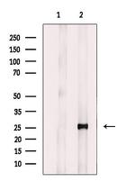 MAD2L2 Antibody in Western Blot (WB)