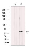 Mast Cell Chymase Antibody in Western Blot (WB)