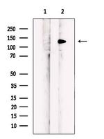 MLXIP Antibody in Western Blot (WB)