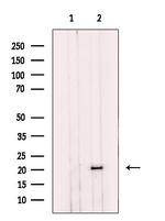 NDUFS7 Antibody in Western Blot (WB)