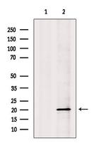 NDUFS7 Antibody in Western Blot (WB)