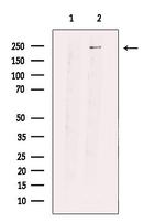 PRP8 Antibody in Western Blot (WB)