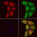 RASGRP3 Antibody in Immunocytochemistry (ICC/IF)