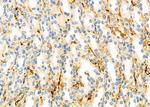 SACM1L Antibody in Immunohistochemistry (Paraffin) (IHC (P))