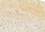 SH2D1B Antibody in Immunohistochemistry (Paraffin) (IHC (P))