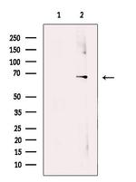 SLC38A3 Antibody in Western Blot (WB)