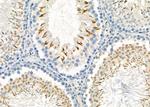 STC2 Antibody in Immunohistochemistry (Paraffin) (IHC (P))