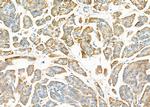 STT3B Antibody in Immunohistochemistry (Paraffin) (IHC (P))