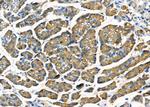 STT3B Antibody in Immunohistochemistry (Paraffin) (IHC (P))