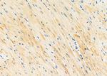 STX16 Antibody in Immunohistochemistry (Paraffin) (IHC (P))