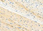 STX16 Antibody in Immunohistochemistry (Paraffin) (IHC (P))