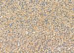 STX16 Antibody in Immunohistochemistry (Paraffin) (IHC (P))