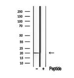 TIMM17B Antibody in Western Blot (WB)